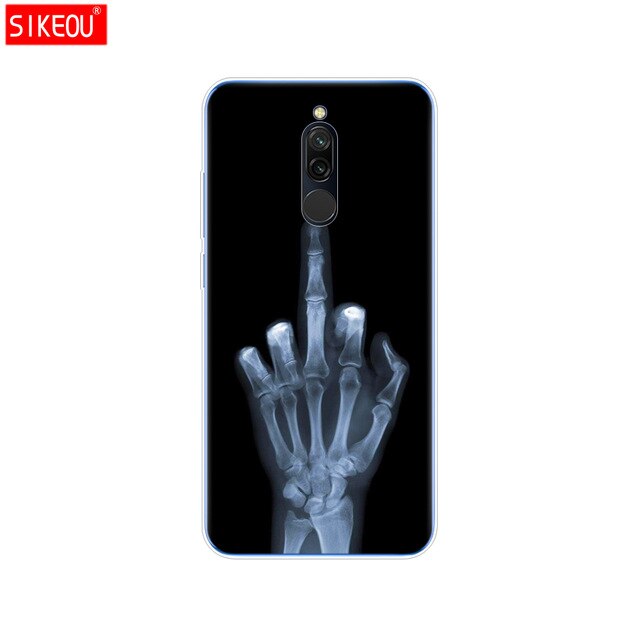 silicon case for xiaomi redmi 8 cases full protection soft tpu back cover on redmi 8 bumper hongmi 8 phone shell bag coque cat